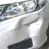 dent-in-car-how-to-fix-dent-in-car